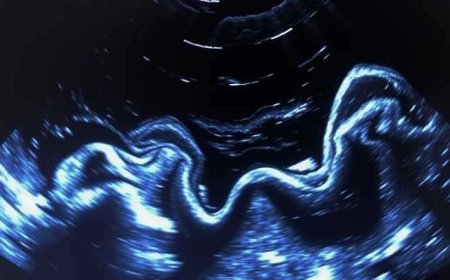 Discover Accurate Heart Imaging with a Portable Echocardiogram Near Me | Medex Diagnostic Services