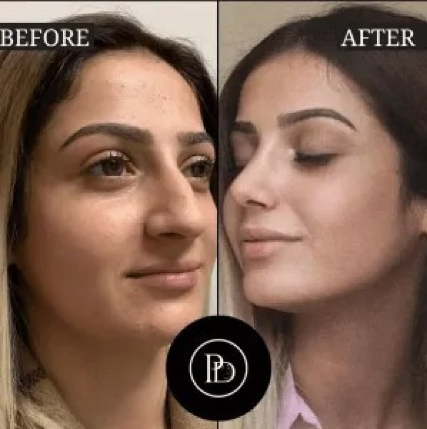 What Makes Someone the Best Plastic Surgeon in Dubai