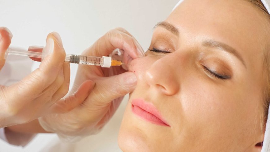 Types of Cheek Fillers Explained: Which One Is Right for You?